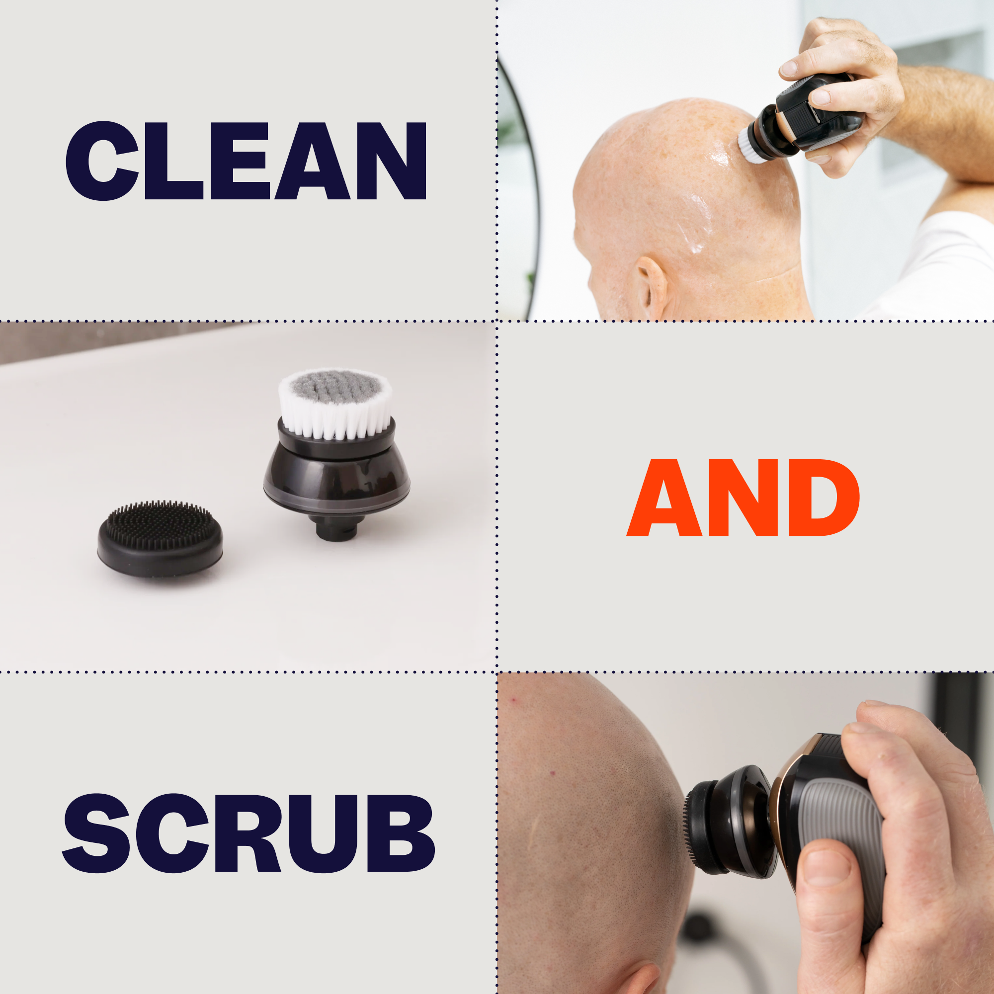 FlexSeries Attachment Kit - Image 7