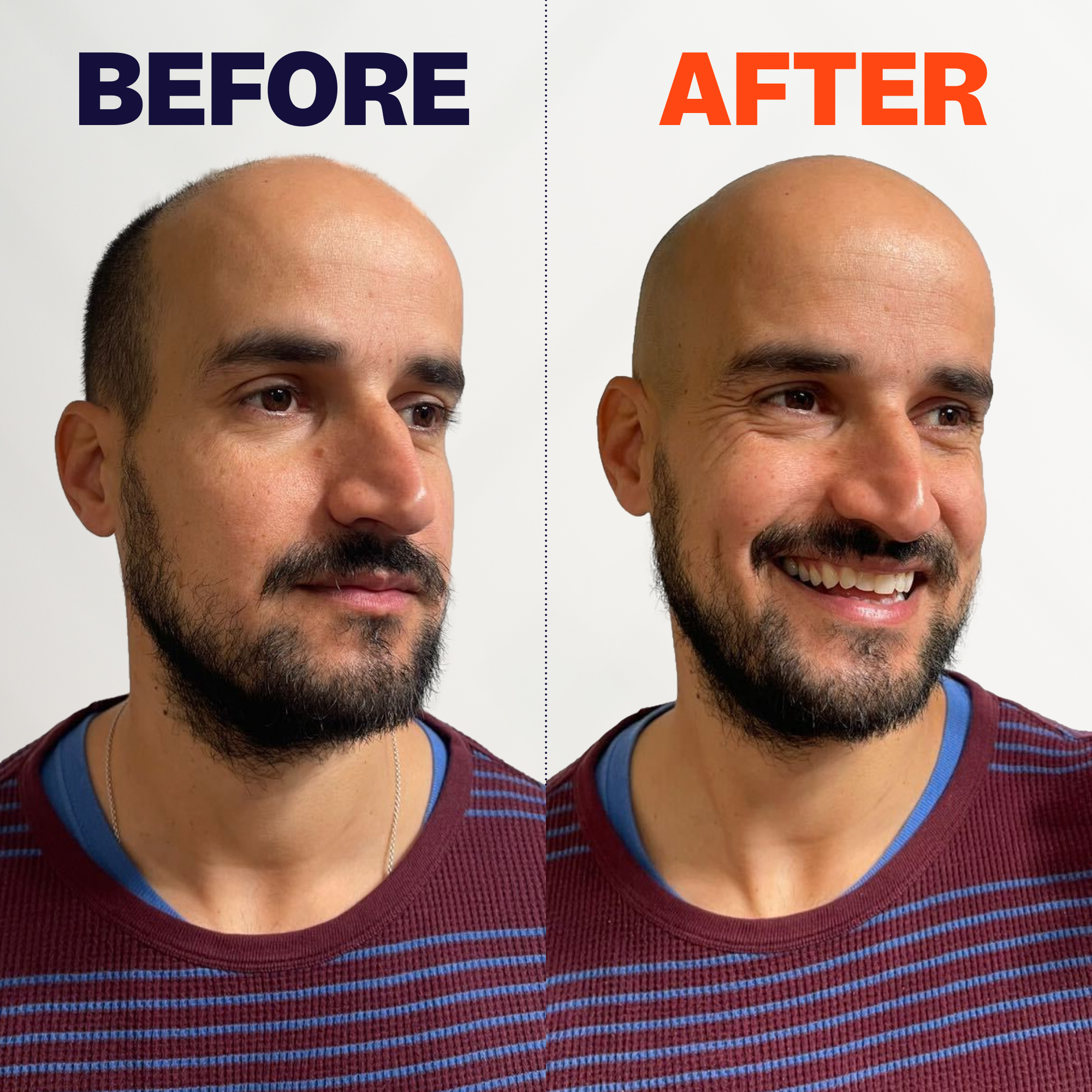 FlexSeries Pro Shaving Kit - Image 4