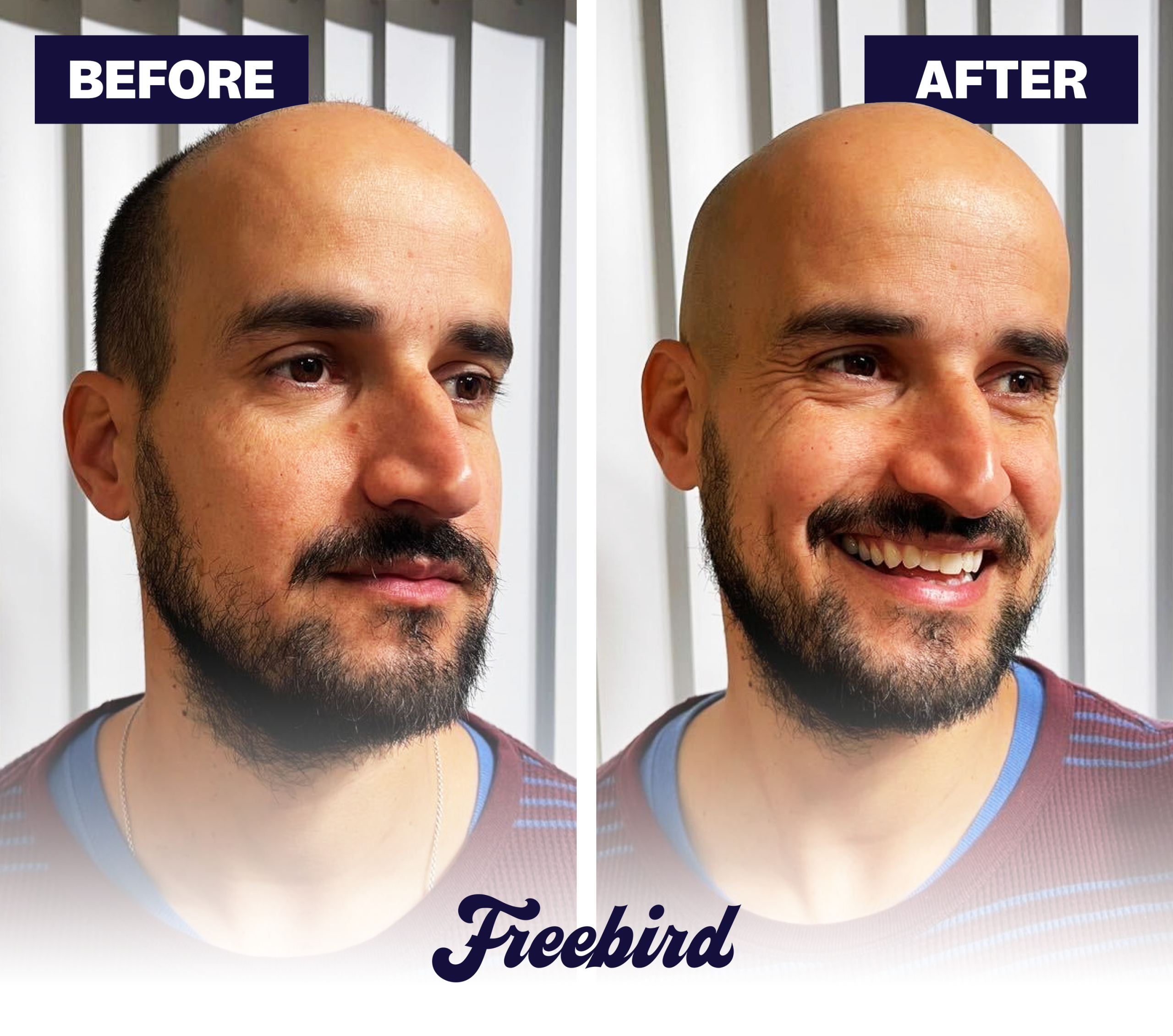 FlexSeries Shaving Kit - Image 3